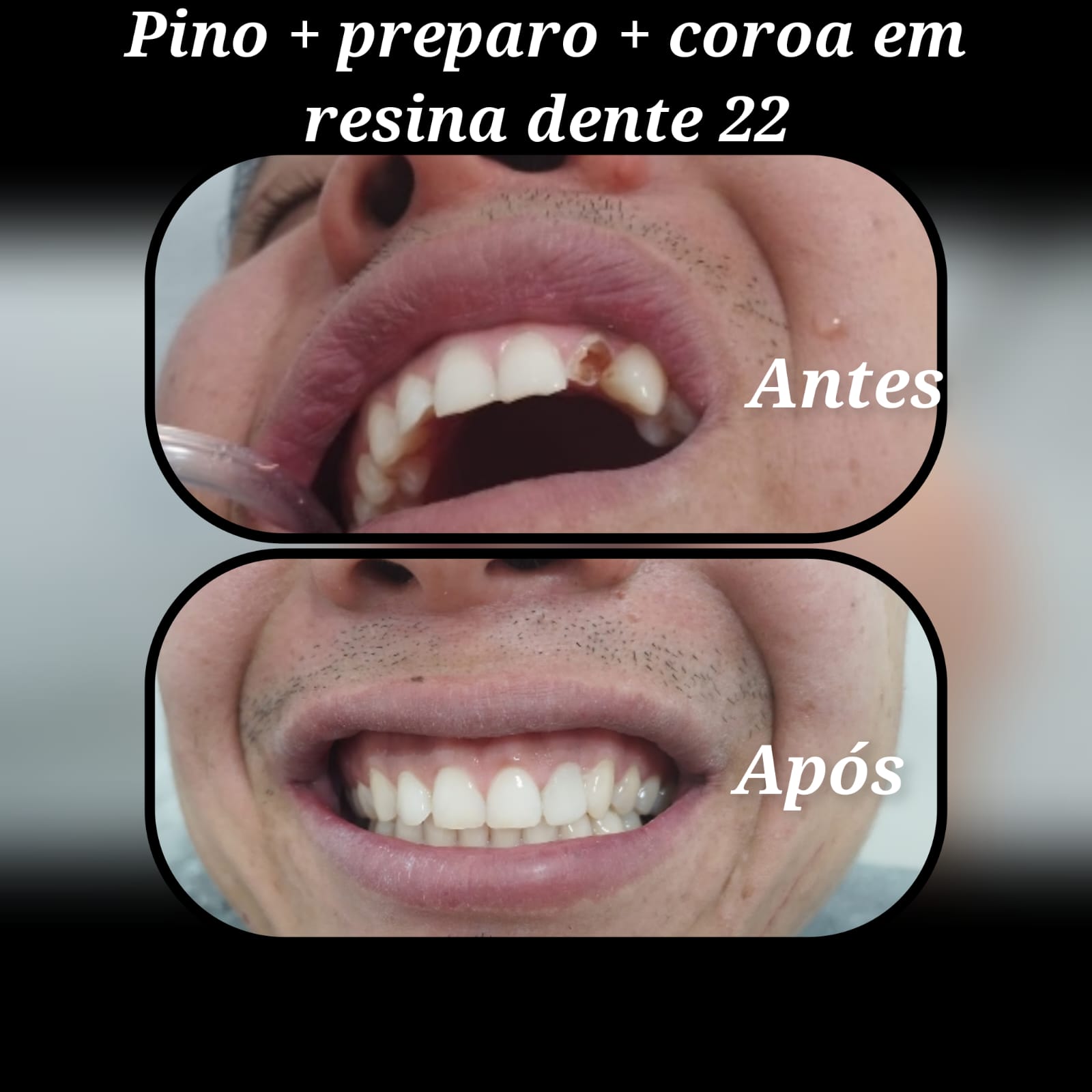 Resultado 2